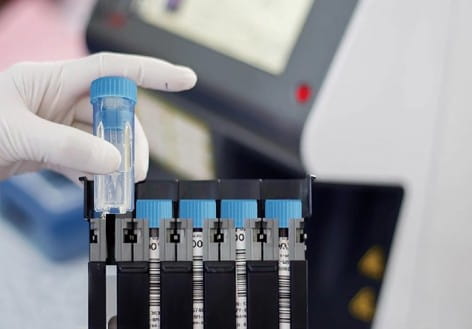 test tubes on a machine