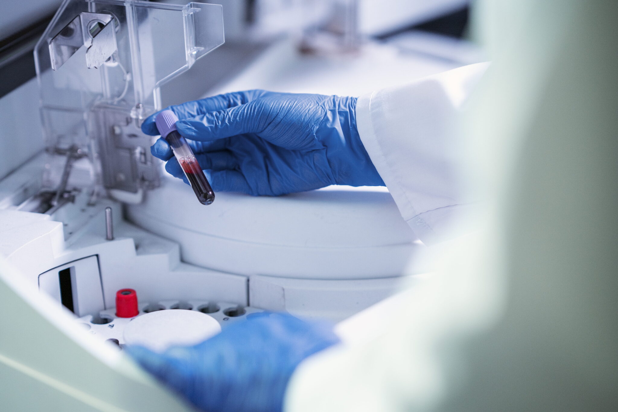 Close up image of a medical technologist’s hand holding a blood sample.