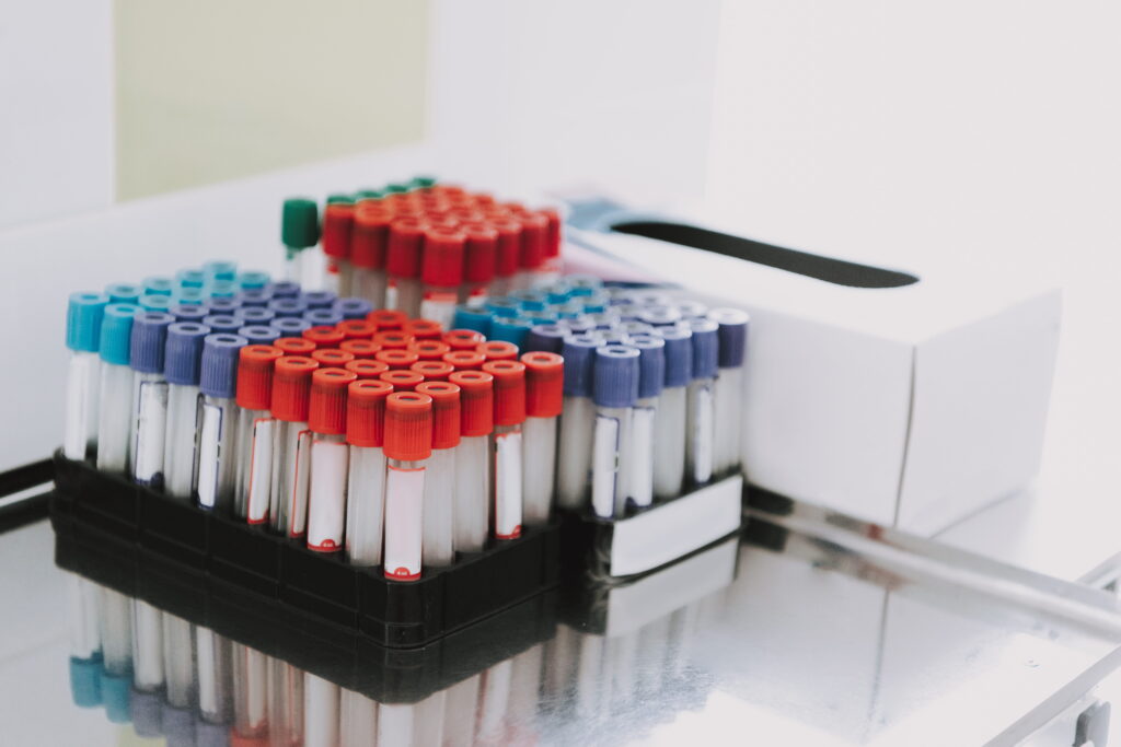 Close-up of test tubes and a box of gloves.
