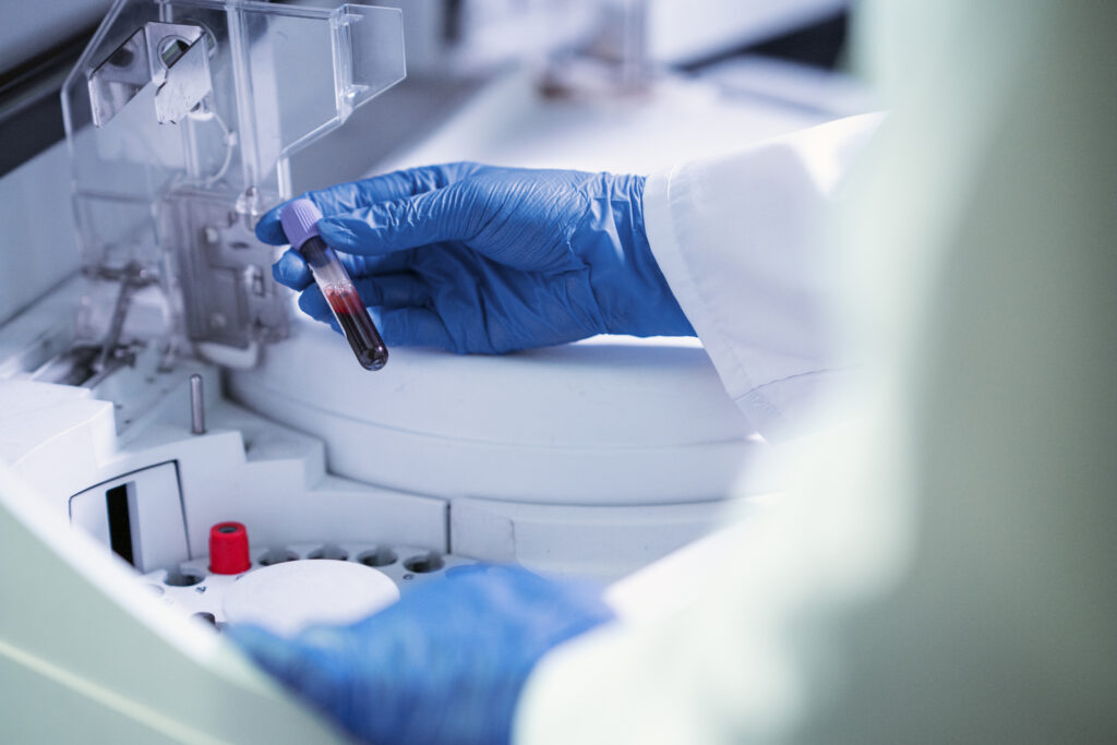 Close up image of a medical professional’s hands handling a blood sample.